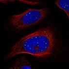 Immunofluorescent staining of human cell line U-2 OS shows localization to nuclear bodies & aggresome.