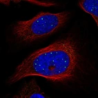 Immunofluorescent staining of human cell line U-2 OS shows localization to nuclear bodies & aggresome.