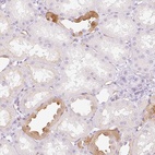 Anti-TAF1L Antibody