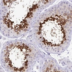 Immunohistochemical staining of human testis shows high expression.