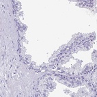 Anti-YBX2 Antibody