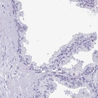 Immunohistochemical staining of human prostate shows low expression as expected.
