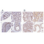 Anti-PPP1R10 Antibody