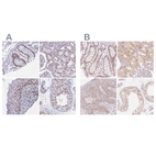 Anti-PPP1R10 Antibody