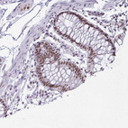 Immunohistochemical staining of human colon shows strong nuclear positivity in glandular cells.