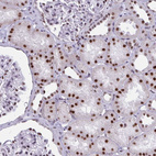 Immunohistochemical staining of human kidney shows strong nuclear positivity in cells in tubules.