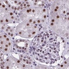 Anti-PPP1R10 Antibody