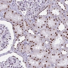 Immunohistochemical staining of human kidney shows strong nuclear positivity in cells in tubules.