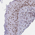 Immunohistochemical staining of human skin shows strong nuclear positivity in squamous epithelial cells.