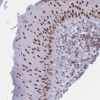 Immunohistochemical staining of human skin shows strong nuclear positivity in squamous epithelial cells.