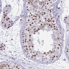 Immunohistochemical staining of human testis shows strong nuclear positivity in cells in seminiferous ducts.