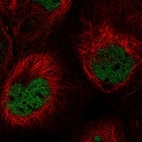 Immunofluorescent staining of human cell line A-431 shows localization to nucleoplasm.