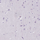 Immunohistochemical staining of human cerebral cortex shows no positivity in neuronal cells as expected.
