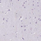 Immunohistochemical staining of human cerebral cortex shows no positivity in neuronal cells as expected.