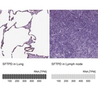 Anti-SFTPD Antibody