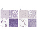 Immunohistochemical staining of human cerebral cortex, kidney, lung and lymph node using Anti-SFTPD antibody HPA056768 (A) shows similar protein distribution across tissues to independent antibody HPA044582 (B).