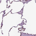 Immunohistochemical staining of human lung shows strong granular cytoplasmic positivity in pneumocytes.