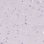 Immunohistochemical staining of human cerebral cortex shows no positivity in neurons as expected.