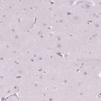 Immunohistochemical staining of human cerebral cortex shows no positivity in neurons as expected.