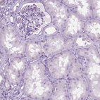 Immunohistochemical staining of human kidney shows no positivity in cells in tubules and glomeruli as expected.