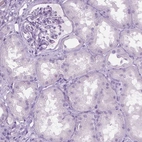 Immunohistochemical staining of human kidney shows no positivity in cells in tubules and glomeruli as expected.