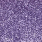 Immunohistochemical staining of human lymph node shows no positivity as expected.