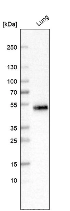 Western blot analysis in human lung tissue.