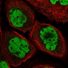 Immunofluorescent staining of human cell line A-431 shows localization to nucleoplasm.