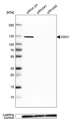 Western blot analysis in MCF-7 cells transfected with control siRNA, target specific siRNA probe #1 and #2, using Anti-CDH1 antibody. Remaining relative intensity is presented. Loading control: Anti-GAPDH.