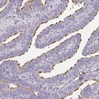Anti-RUNDC3B Antibody