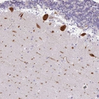 Anti-EEF1A1 Antibody