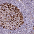 Immunohistochemical staining of human tonsil shows strong cytoplasmic positivity in germinal center cells.