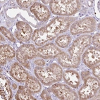 Immunohistochemical staining of human kidney shows moderate cytoplasmic positivity in cells in tubules.