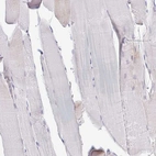 Immunohistochemical staining of human skeletal muscle shows very weak cytoplasmic positivity in myocytes.