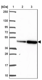 Lane 1: Marker [kDa] 250, 130, 95, 72, 55, 36, 28, 17, 10_br/_Lane 2: Human cell line RT-4_br/_Lane 3: Human cell line U-251MG sp