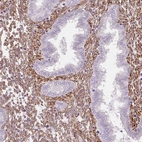 Immunohistochemical staining of human endometrium shows strong cytoplasmic positivity in stromal cells.