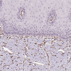 Anti-FKBP10 Antibody