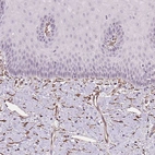 Immunohistochemical staining of human uterine cervix shows strong cytoplasmic positivity in fibroblasts.