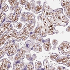Immunohistochemical staining of human placenta shows moderate to strong cytoplasmic positivity in fibroblasts.