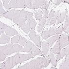 Immunohistochemical staining of human skeletal muscle shows no positivity in myocytes as expected.