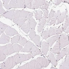 Immunohistochemical staining of human skeletal muscle shows no positivity in myocytes as expected.