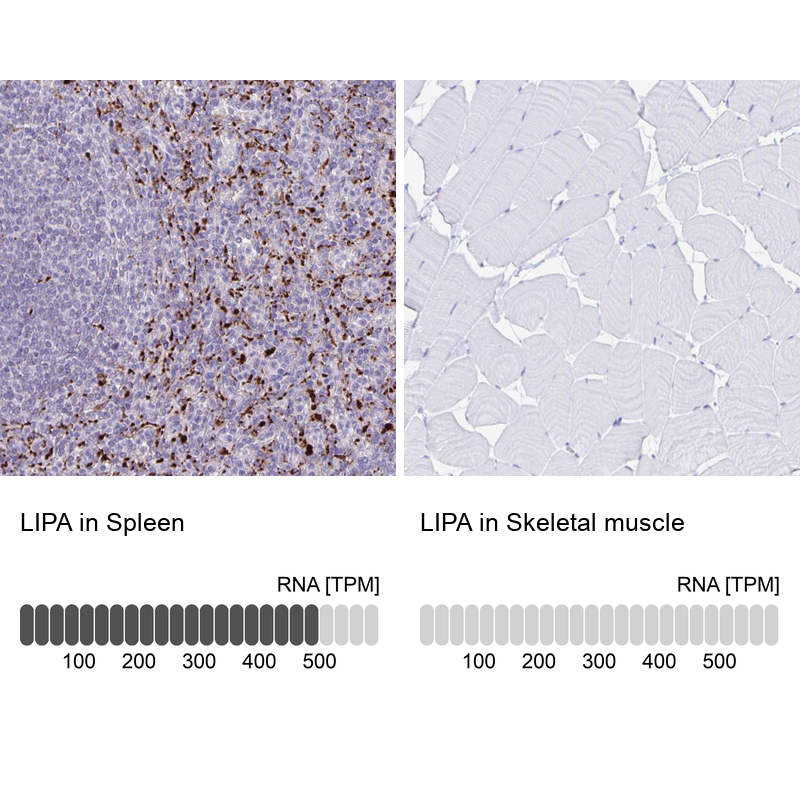 Anti-LIPA Antibody