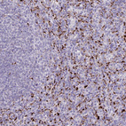 Immunohistochemical staining of human spleen shows strong cytoplasmic positivity in cells in red pulp.