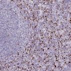 Immunohistochemical staining of human spleen shows strong cytoplasmic positivity in cells in red pulp.