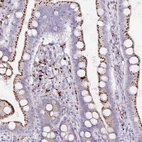 Immunohistochemical staining of human duodenum shows strong granular cytoplasmic positivity in glandular cells.