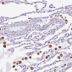 Immunohistochemical staining of human lung shows moderate cytoplasmic positivity in macrophages.