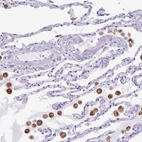 Immunohistochemical staining of human lung shows moderate cytoplasmic positivity in macrophages.
