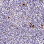 Immunohistochemical staining of human lymphoid tissues shows strong cytoplasmic positivity in a subset of non-germinal center cells.