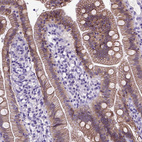 Anti-CDH1 Antibody