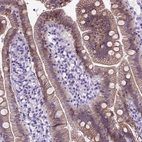 Immunohistochemical staining of human duodenum shows moderate membranous positivity in glandular cells.
